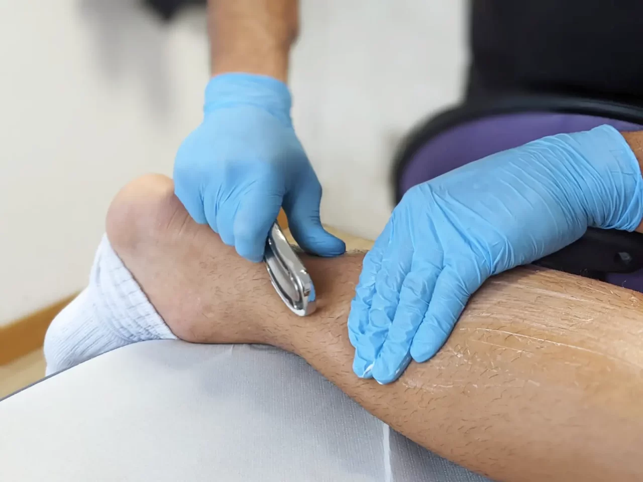 Tecar terapia